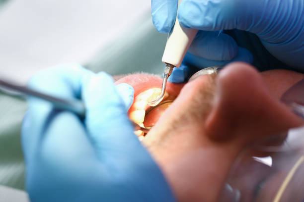 Best Pediatric Emergency Dentist in Sterlington, LA